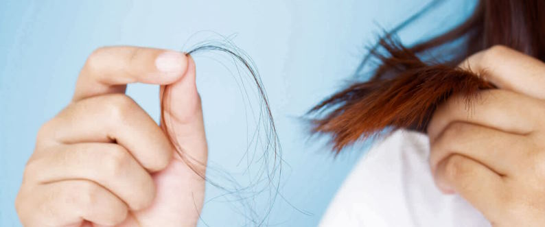 hormonal-related hair issues